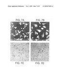 Human IgM antibodies, and diagnostic and therapeutic uses thereof particularly in the central nervous system diagram and image