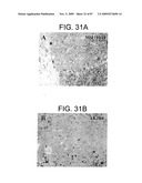 Human IgM antibodies, and diagnostic and therapeutic uses thereof particularly in the central nervous system diagram and image