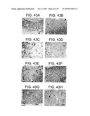 Human IgM antibodies, and diagnostic and therapeutic uses thereof particularly in the central nervous system diagram and image