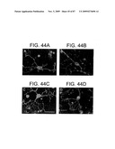 Human IgM antibodies, and diagnostic and therapeutic uses thereof particularly in the central nervous system diagram and image