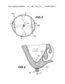 BONE CUTTING DEVICE AND METHOD OF USING SAME diagram and image