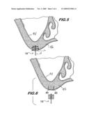 BONE CUTTING DEVICE AND METHOD OF USING SAME diagram and image