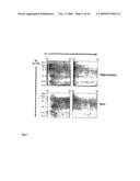 METHODS AND COMPOSITIONS RELATING TO ALZHEIMER S DISEASE diagram and image