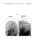 METHOD FOR STIMULATING ANGIOGENESIS USING DKK2 AND COMPOSITION COMPRISING THE SAME diagram and image