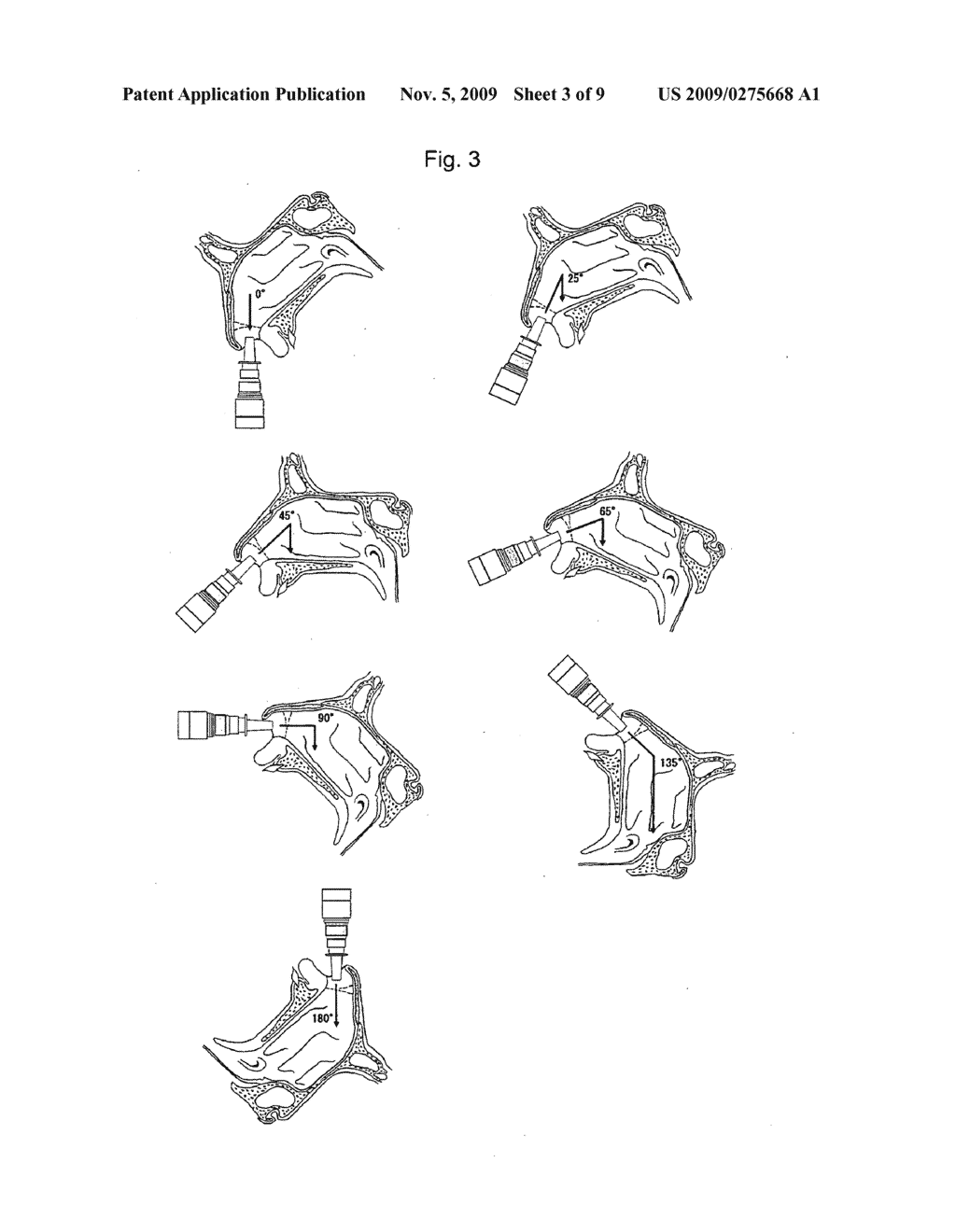 Sprayable Gel-Type Skin/Mucosa-Adhesive Preparation and Administration System Using the Preparation - diagram, schematic, and image 04