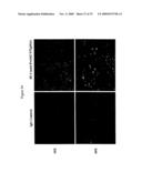 Use of A33 antigens and jam-it diagram and image