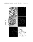 Use of A33 antigens and jam-it diagram and image