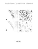 Use of A33 antigens and jam-it diagram and image