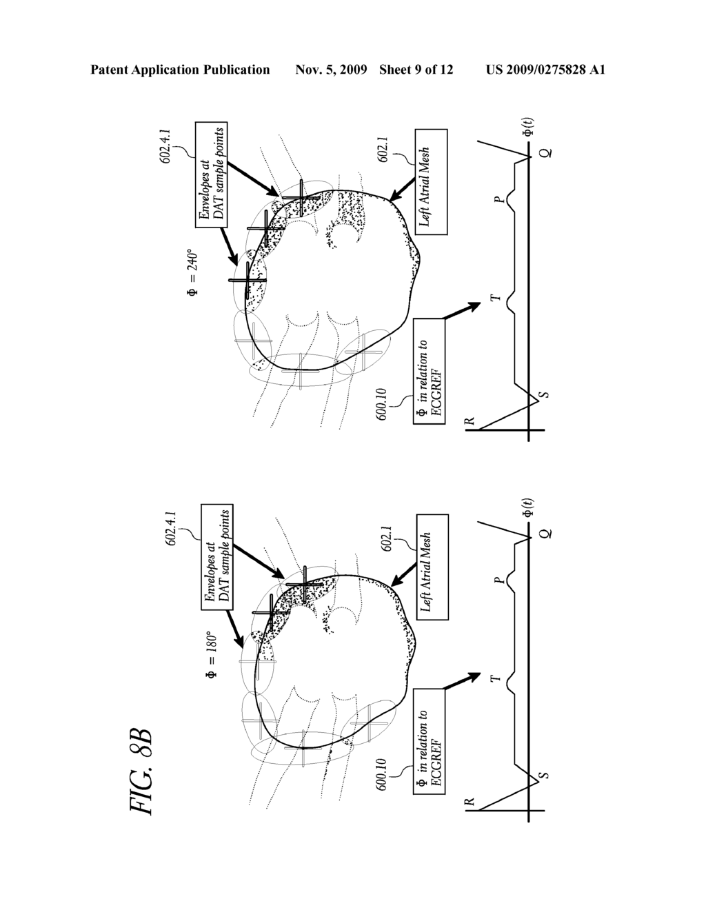 METHOD AND APPARATUS FOR CREATING A HIGH RESOLUTION MAP OF THE ELECTRICAL AND MECHANICAL PROPERTIES OF THE HEART - diagram, schematic, and image 10