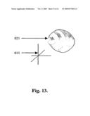 Methods and Systems for Lesion Localization, Definition and Verification diagram and image