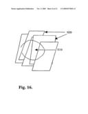 Methods and Systems for Lesion Localization, Definition and Verification diagram and image