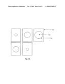 Methods and Systems for Lesion Localization, Definition and Verification diagram and image