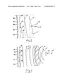 Lithotripsy system with automatic 3D tracking diagram and image