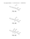 STABILIZATION OF VISUALIZATION CATHETERS diagram and image