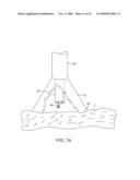 STABILIZATION OF VISUALIZATION CATHETERS diagram and image