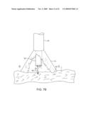 STABILIZATION OF VISUALIZATION CATHETERS diagram and image