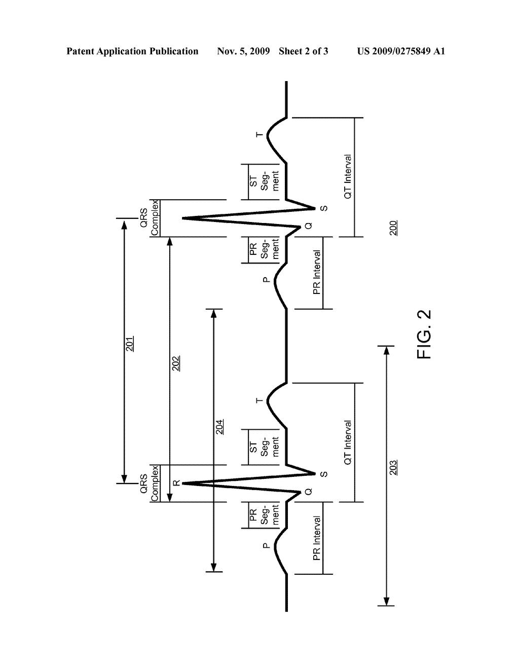 Methods for Detection of Cardiac Arrhythmias - diagram, schematic, and image 03