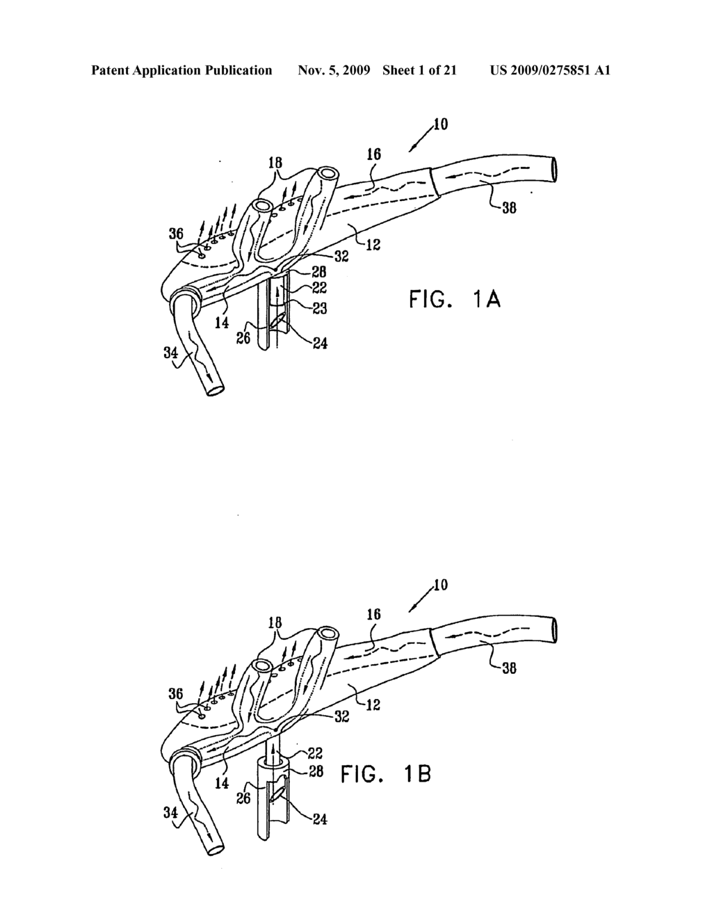 Endoscopic Bite Block - diagram, schematic, and image 02