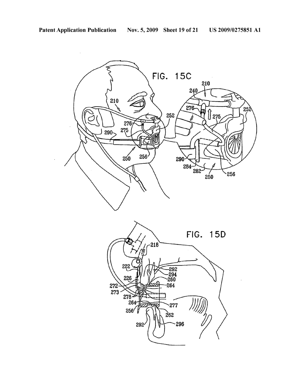 Endoscopic Bite Block - diagram, schematic, and image 20