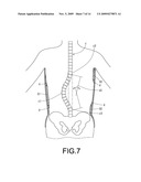 BACK BRACE FOR SPINAL CORRECTION AND ITS MANUFACTURING METHOD diagram and image