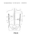 BACK BRACE FOR SPINAL CORRECTION AND ITS MANUFACTURING METHOD diagram and image