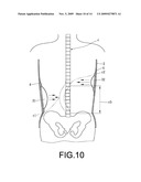 BACK BRACE FOR SPINAL CORRECTION AND ITS MANUFACTURING METHOD diagram and image