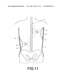 BACK BRACE FOR SPINAL CORRECTION AND ITS MANUFACTURING METHOD diagram and image