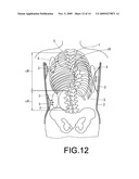 BACK BRACE FOR SPINAL CORRECTION AND ITS MANUFACTURING METHOD diagram and image