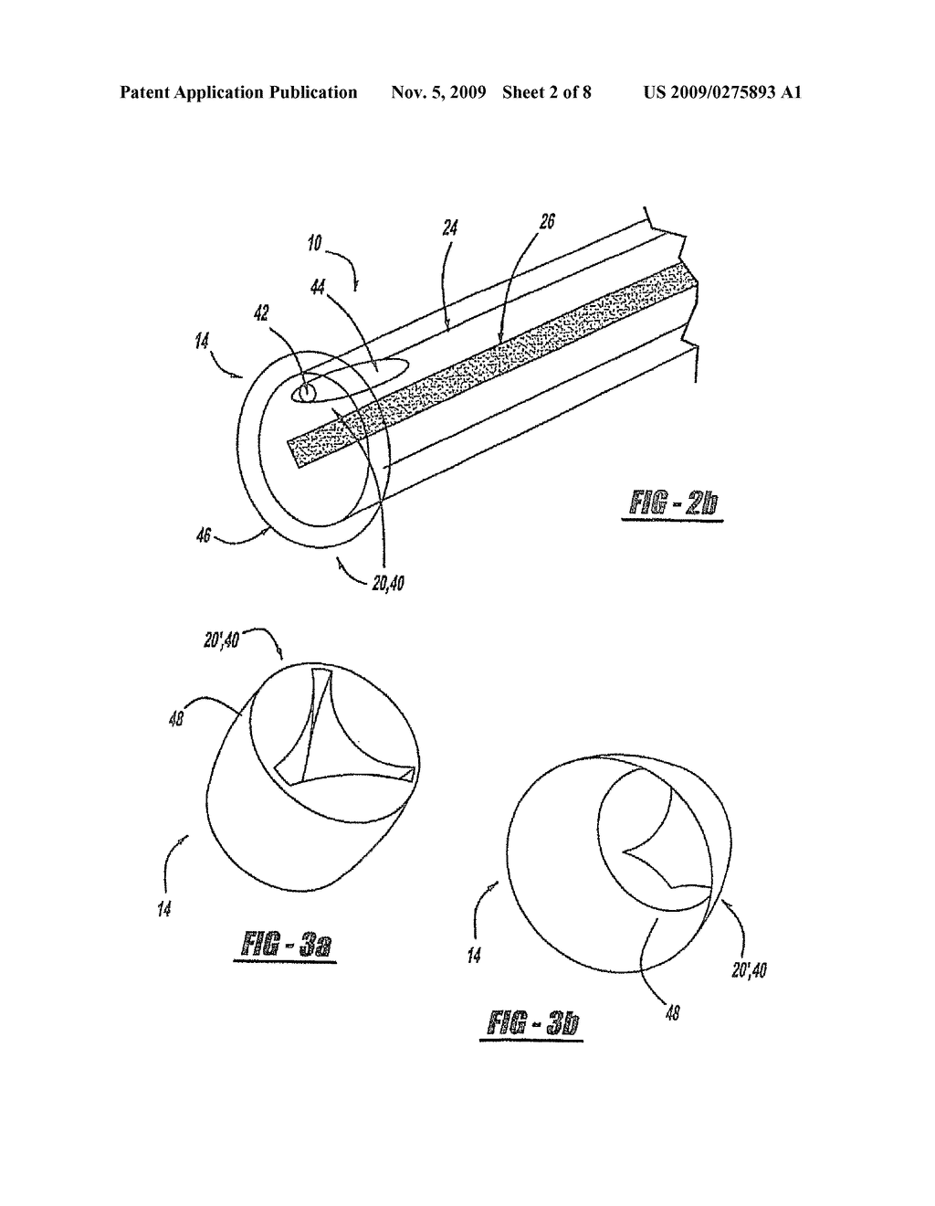 INSTRUMENT PORT FOR MINIMALLY INVASIVE CARDIAC SURGERY - diagram, schematic, and image 03