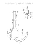 Medical suction device diagram and image