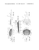 ENDPLATE PREPARATION INSTRUMENT diagram and image