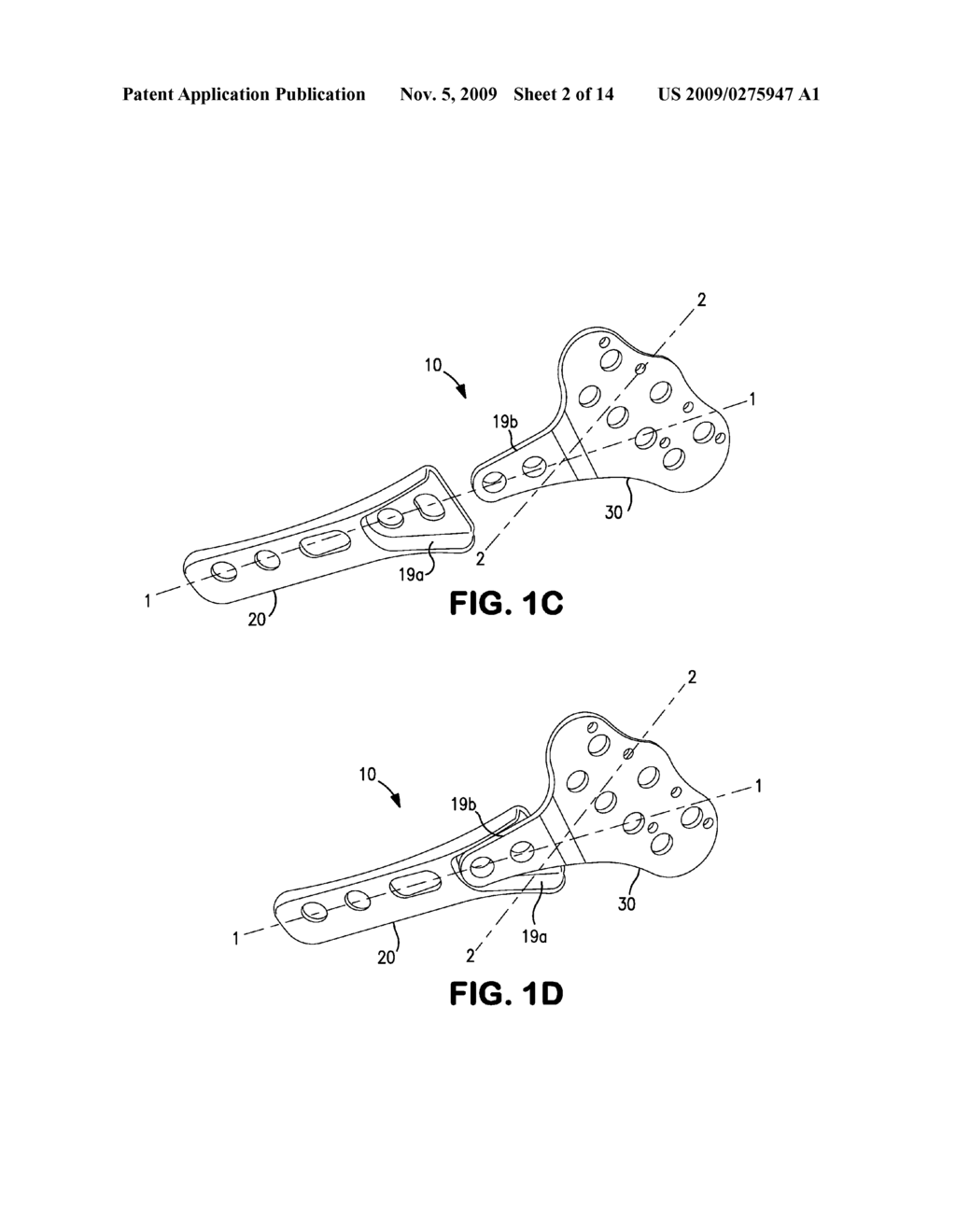 BONE PLATE SYSTEM FOR BONE RESTORATION AND METHODS OF USE THEREOF - diagram, schematic, and image 03