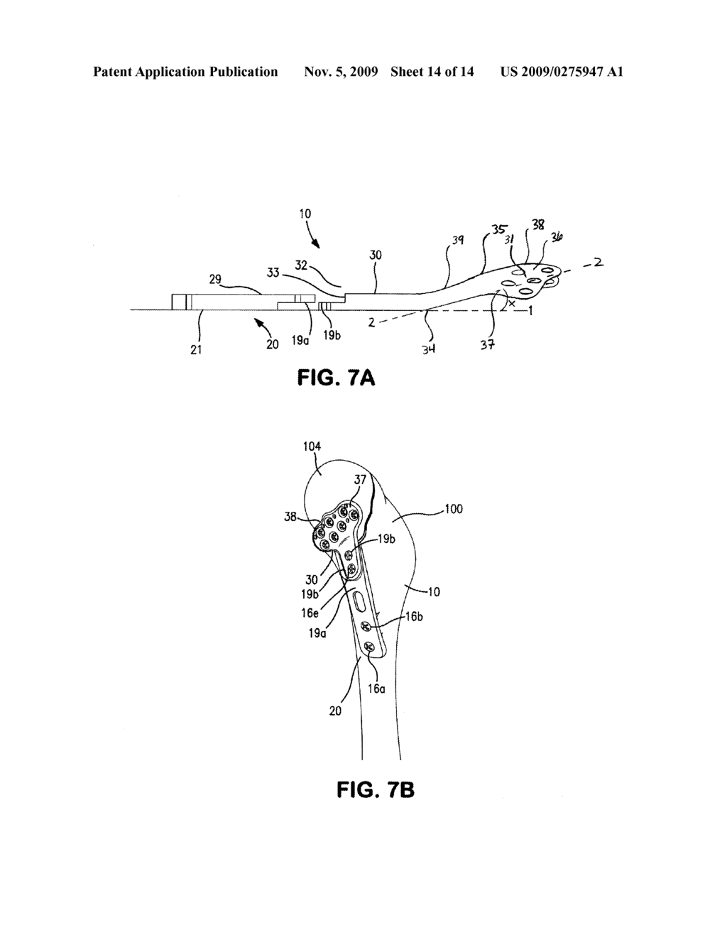 BONE PLATE SYSTEM FOR BONE RESTORATION AND METHODS OF USE THEREOF - diagram, schematic, and image 15