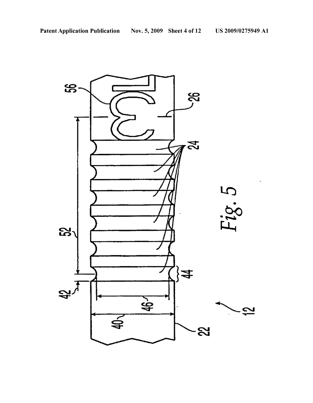 ADJUSTABLE LENGTH TAP AND METHOD FOR DRILLING AND TAPPING A BORE IN BONE - diagram, schematic, and image 05