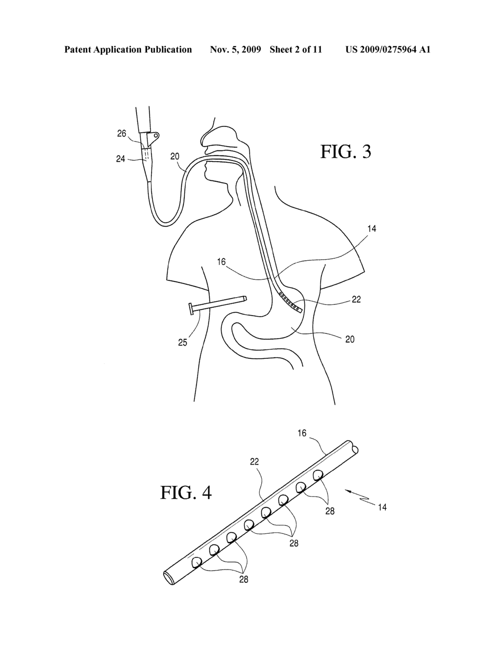 METHOD OF ROLLING STOMACH TISSUE SO AS TO MAXIMIZE THE CONTACT SURFACE AREA OF A FOLD - diagram, schematic, and image 03