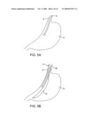 DEVICES AND SYSTEMS FOR GASTRIC VOLUME CONTROL diagram and image