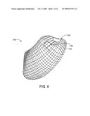 DEVICES AND SYSTEMS FOR GASTRIC VOLUME CONTROL diagram and image