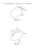 DEVICES AND SYSTEMS FOR GASTRIC VOLUME CONTROL diagram and image