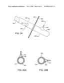 DEVICES AND SYSTEMS FOR GASTRIC VOLUME CONTROL diagram and image