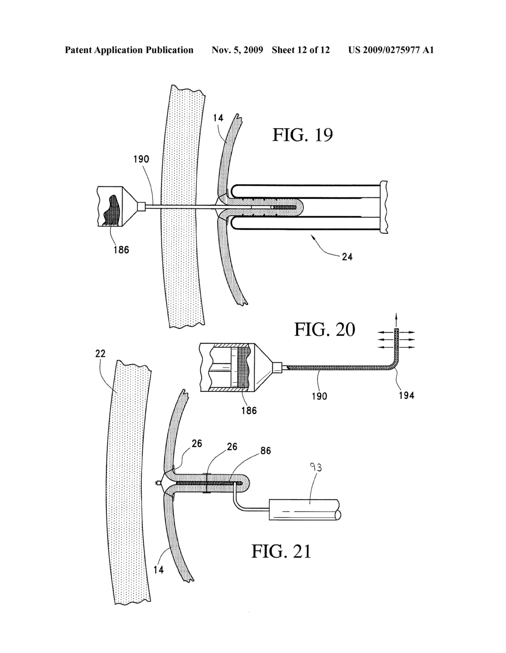 TISSUE CONVEYOR FOR USE IN GASTRIC REDUCTION SURGERY AND ASSOCIATED METHOD FOR USE - diagram, schematic, and image 13