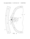 METHOD AND APPARATUS FOR THE FORMATION OF TISSUE FOLDS diagram and image