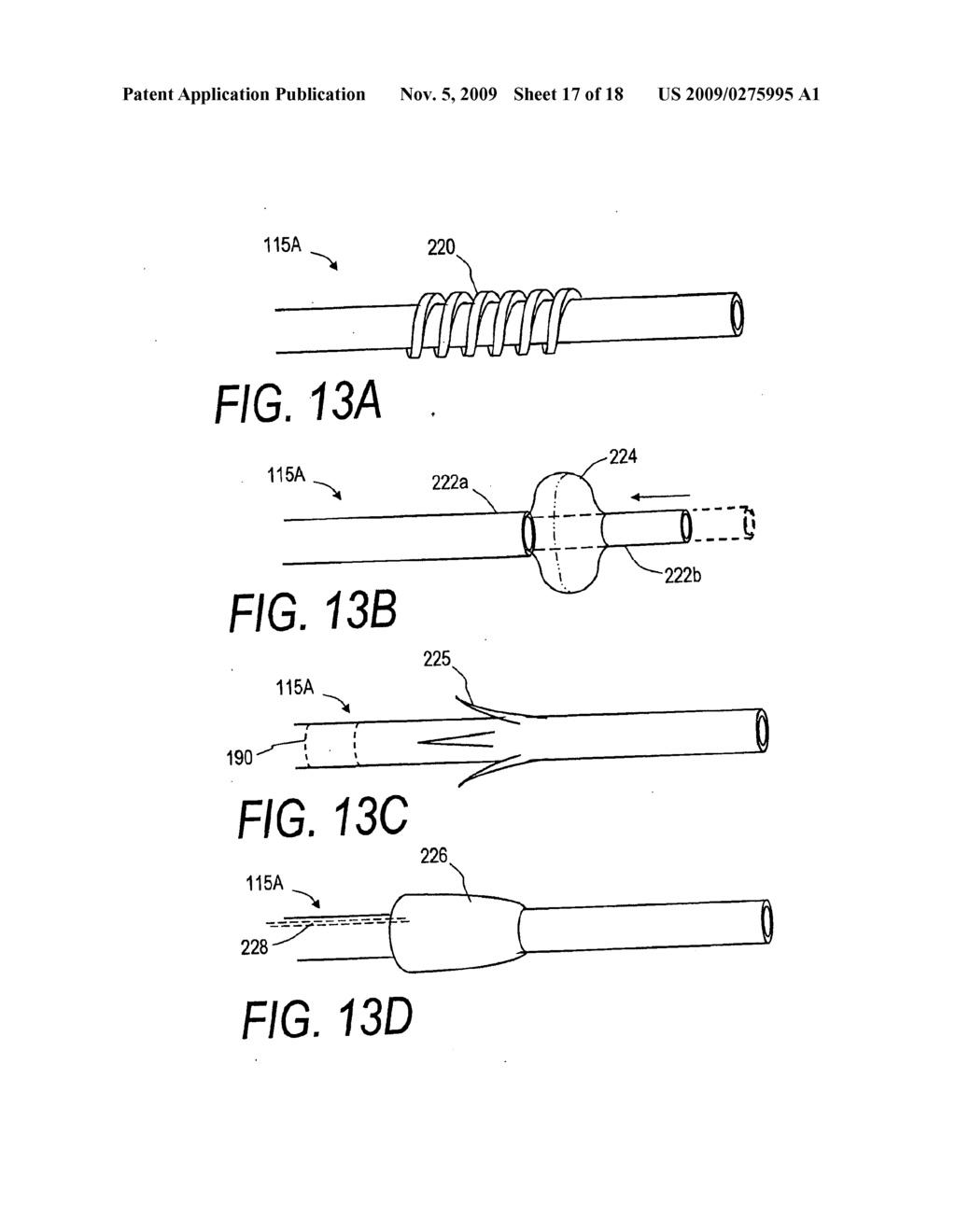 BONE TREATMENT SYSTEMS AND METHODS - diagram, schematic, and image 18