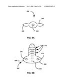 TECHNIQUES FOR PLACING MEDICAL LEADS FOR ELECTRICAL STIMULATION OF NERVE TISSUE diagram and image