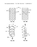 TECHNIQUES FOR PLACING MEDICAL LEADS FOR ELECTRICAL STIMULATION OF NERVE TISSUE diagram and image