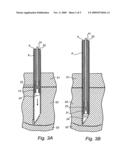 Electrode for Implantation in a Living Organ and a Method for Implanting the Elecrode diagram and image