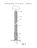 Electrode for Implantation in a Living Organ and a Method for Implanting the Elecrode diagram and image