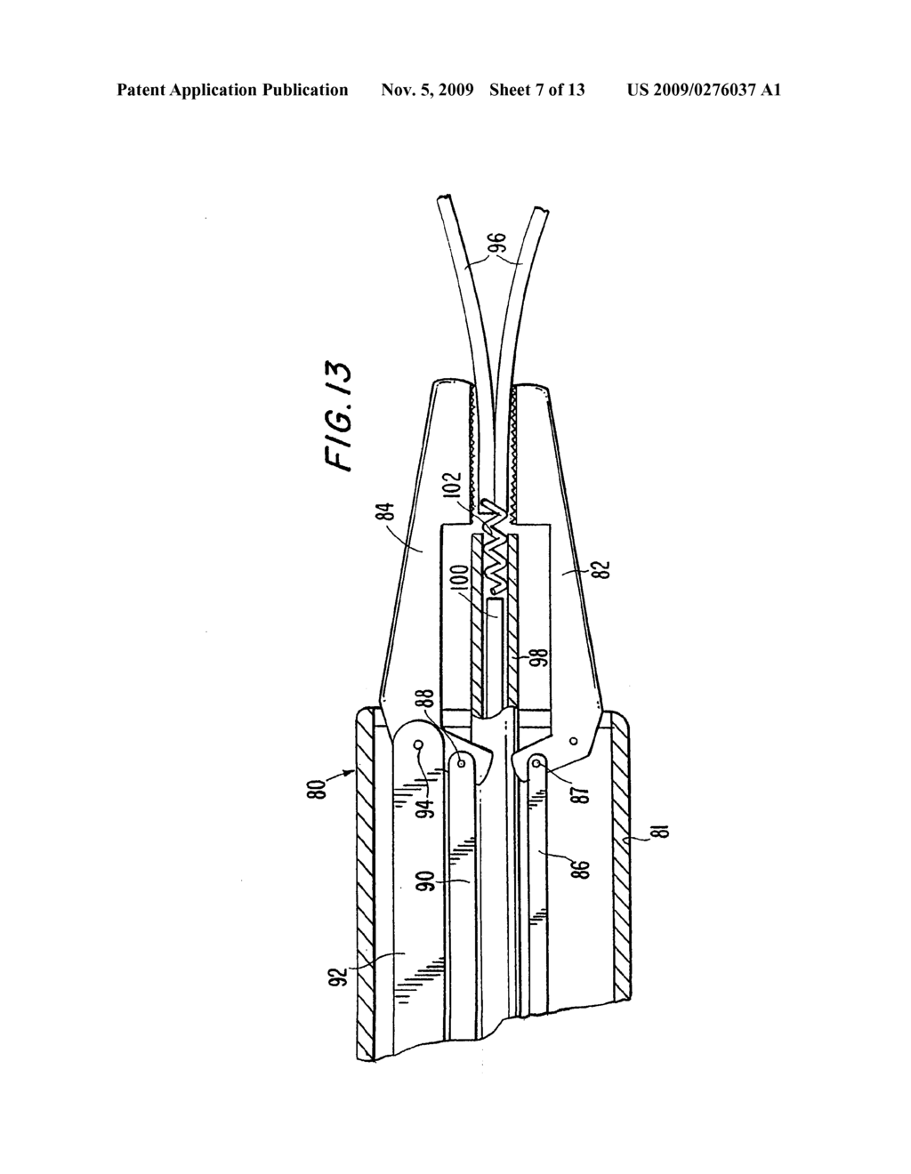 Method And Apparatus For Circulatory Valve Repair - diagram, schematic, and image 08