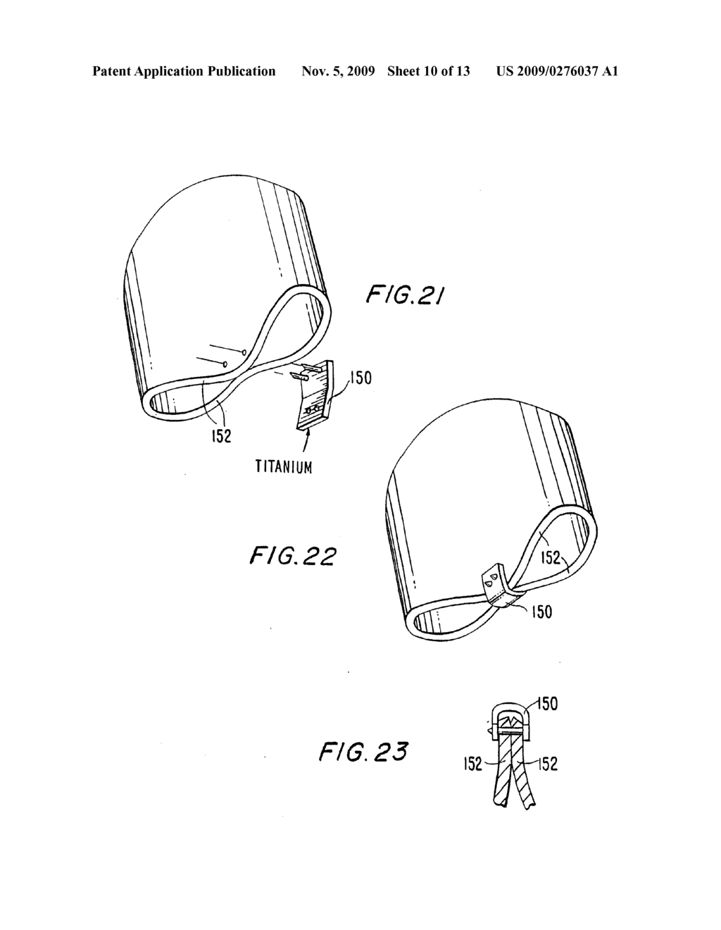 Method And Apparatus For Circulatory Valve Repair - diagram, schematic, and image 11