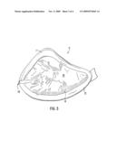 TWO-LAYER EXTERNAL BREAST PROSTHESIS WITH SELF-SHAPING FEATURE AND PROCESS FOR MANUFACTURE THEREOF diagram and image