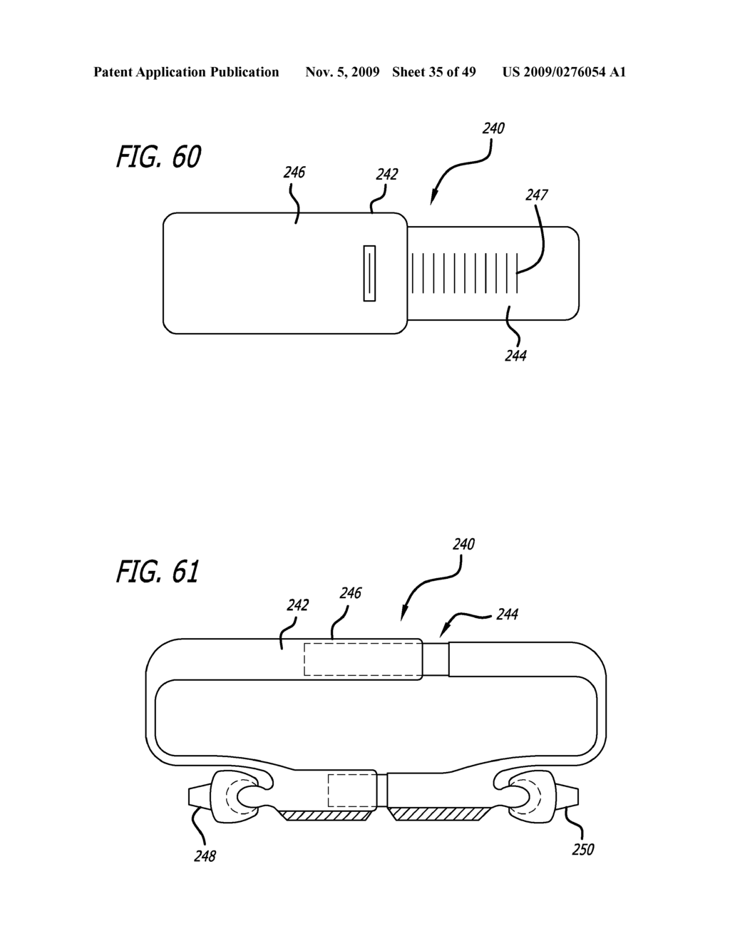 SURGICAL IMPLANTATION METHOD AND DEVICES FOR AN EXTRA-ARTICULAR MECHANICAL ENERGY ABSORBING APPARATUS - diagram, schematic, and image 36